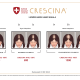 Crescina Transdermic HFSC 500* naistele 20 ampulli 3.5 ml